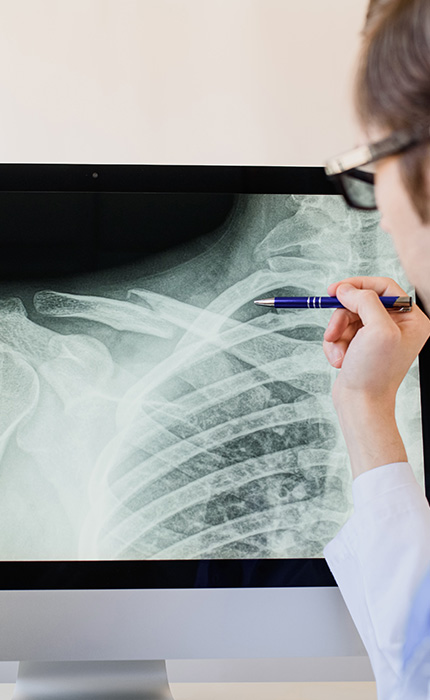 MRT (Magnetresonanztomographie), CT (Computertomographie) | Interventionelle Radiologie | Praxis für Radiologie & Nuklearmedizin