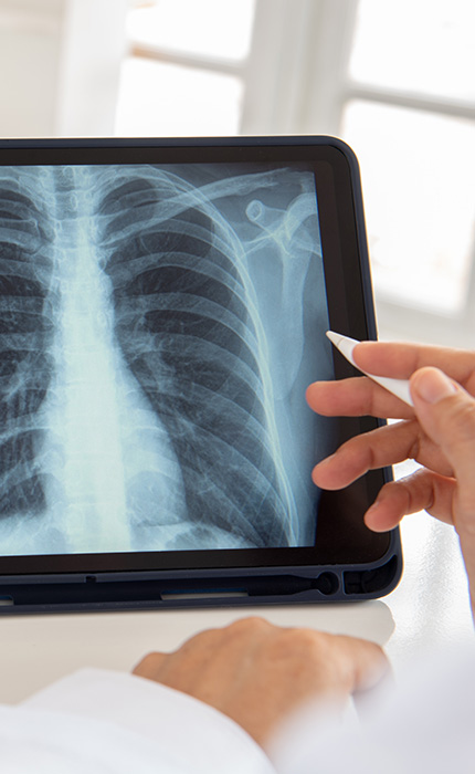 Nuklearmedizin, Bildgebende Verfahren | Röntgenaufnahmen | Praxis für Radiologie & Nuklearmedizin