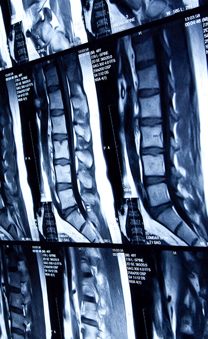 Radiologisches Gutachten, Nuklearmedizin | Strahlenexposition | Praxis für Radiologie & Nuklearmedizin