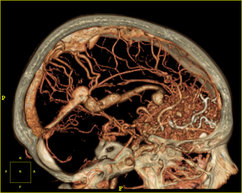 MRT (Magnetresonanztomographie), Radiologische Diagnostik | Strahlenexposition | Praxis für Radiologie & Nuklearmedizin