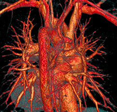 Radiologische Diagnostik, CT (Computertomographie) | Strahlenexposition | Praxis für Radiologie & Nuklearmedizin