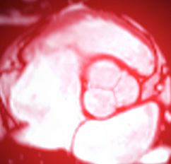 MRT (Magnetresonanztomographie), Radiologisches Gutachten | Röntgenaufnahmen | Praxis für Radiologie & Nuklearmedizin