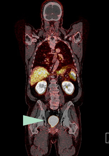 MRT (Magnetresonanztomographie), Radiologisches Gutachten | Röntgenaufnahmen | Praxis für Radiologie & Nuklearmedizin
