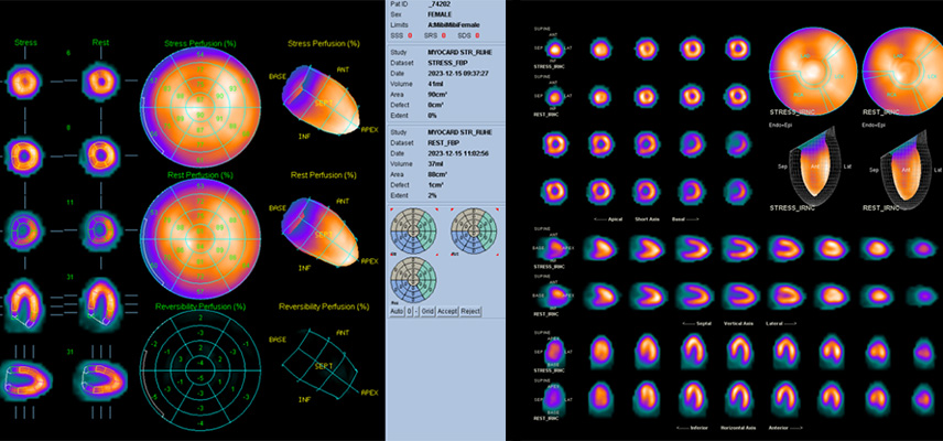 Ultraschalluntersuchungen, Strahlentherapie | Radiologischer Befundbericht | Praxis für Radiologie & Nuklearmedizin