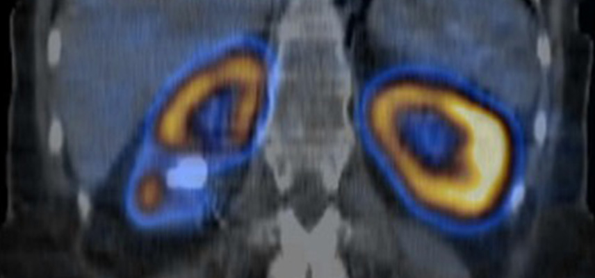 CT (Computertomographie), MRT (Magnetresonanztomographie) | Röntgenaufnahmen | Praxis für Radiologie & Nuklearmedizin