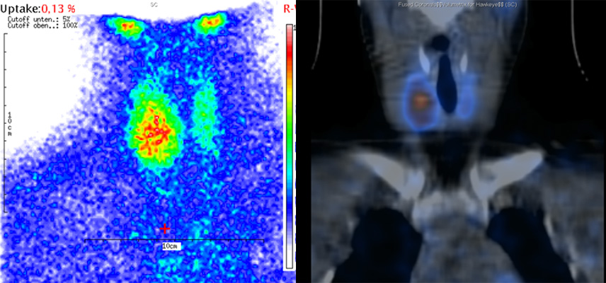 MRT (Magnetresonanztomographie), Ultraschalluntersuchungen | Radiologischer Befund | Praxis für Radiologie & Nuklearmedizin