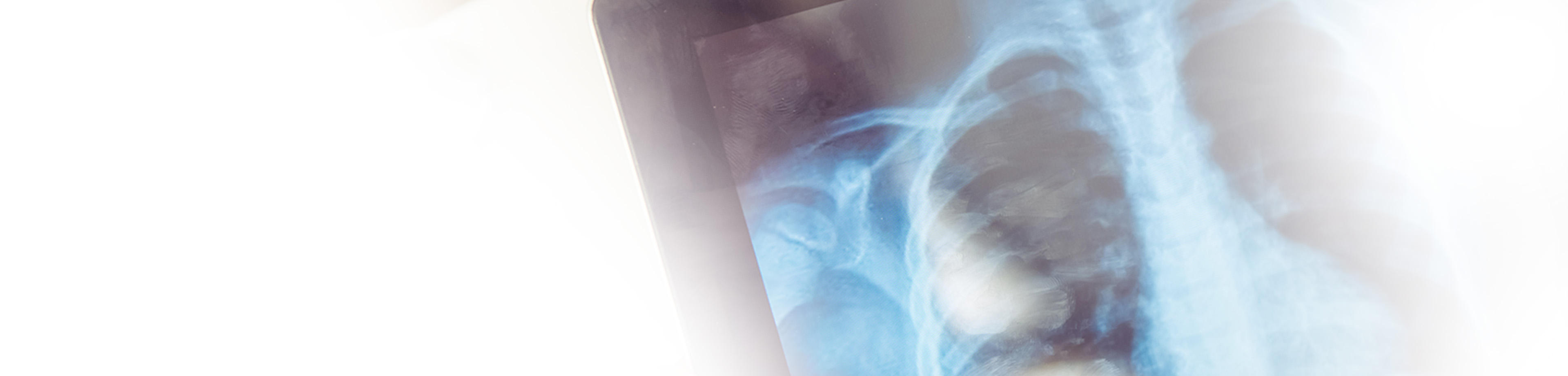 Nuklearmedizin, CT (Computertomographie) | Radiologischer Befundbericht | Praxis für Radiologie & Nuklearmedizin