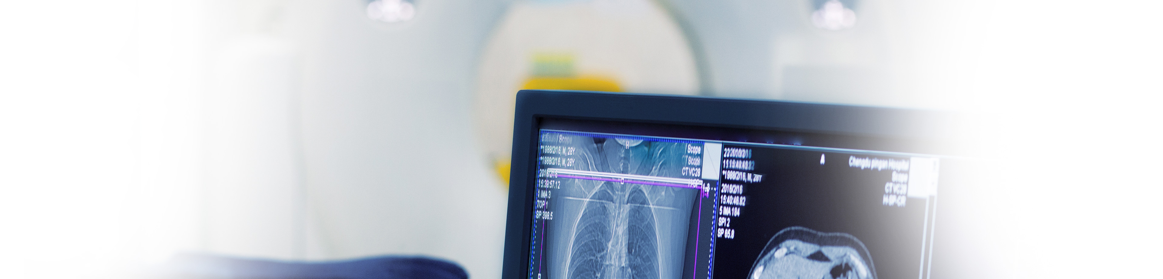 Nuklearmedizin, Ultraschalluntersuchungen | Interventionelle Radiologie | Praxis für Radiologie & Nuklearmedizin